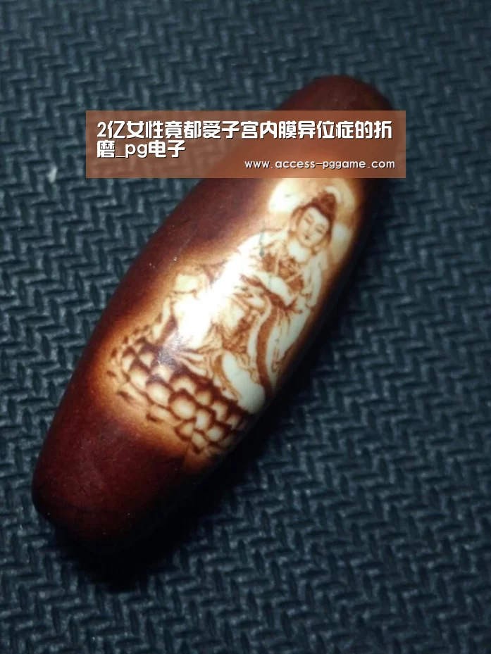 2亿女性竟都受子宫内膜异位症的折磨_pg电子(图1) pg电子游戏