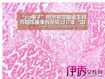 “pg电子”热烈祝贺基蛋生物苏恩本董事长荣获2017年“中国体外诊断领军人物”称号!(图3) PG Soft